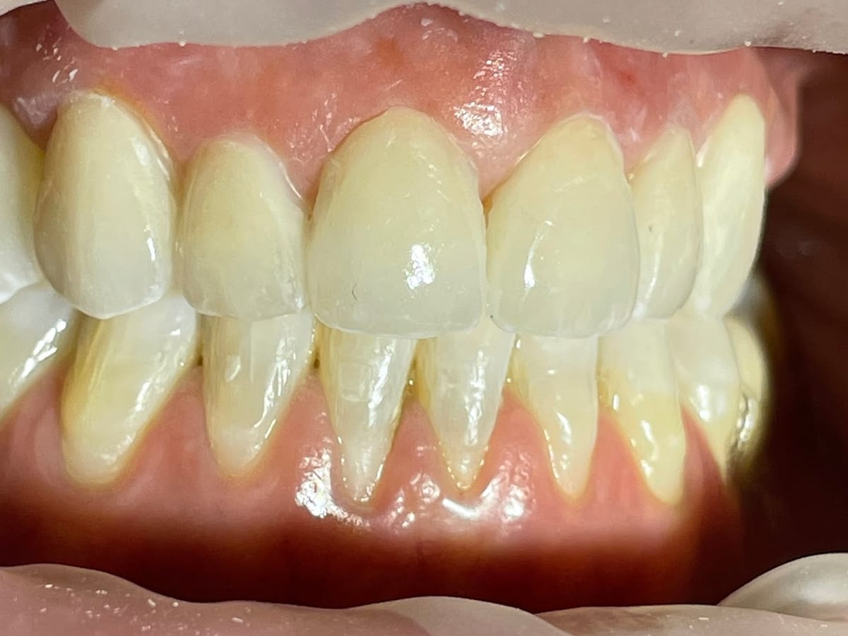 Clínica dental Las Chapas - Dentistas en Málaga — foto 3